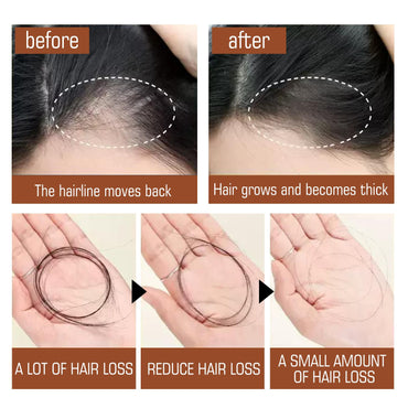 Before and after results of Natural Hair Regrowth Oil for Thick & Healthy Hair showing reduced hair loss and thicker hair.