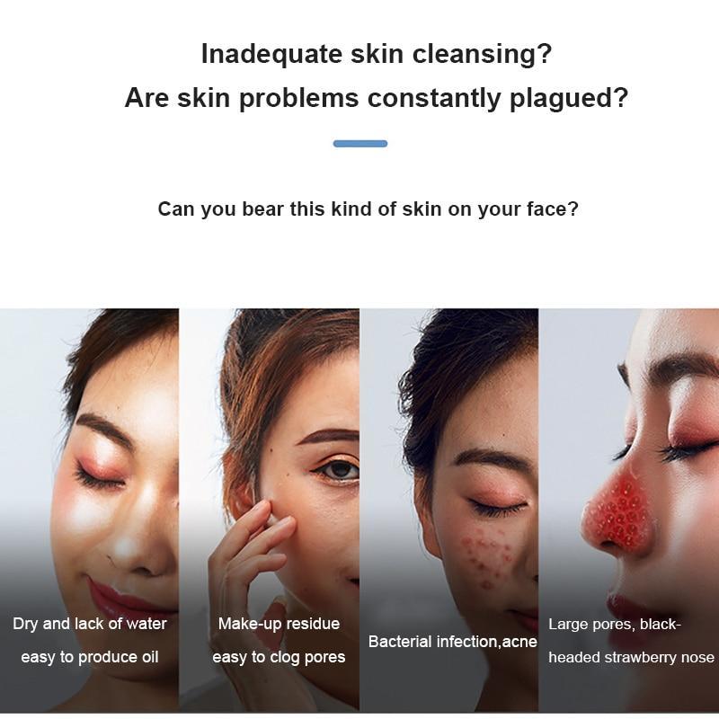 Electric Blackhead Vacuum Remover addressing common skin issues like dry skin, make-up residue, and large pores.