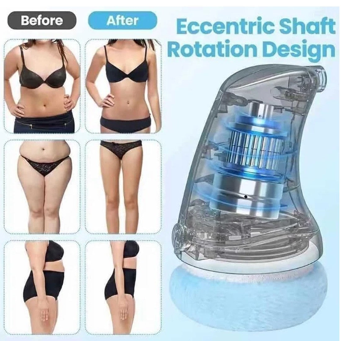 Electric Cellulite Massager Body Sculpting Lifting Device with before and after results showcasing effectiveness.