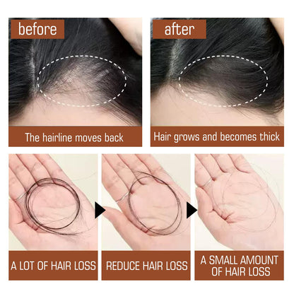 Before and after results of Natural Hair Regrowth Oil for Thick & Healthy Hair showing reduced hair loss and thicker hair.