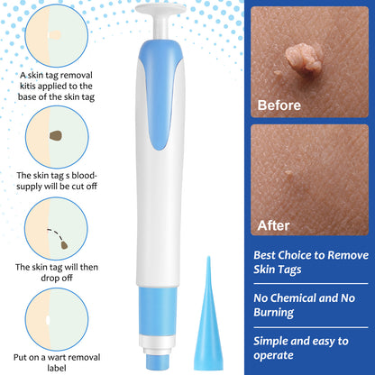 Skin Tag Removal Kit with Cleansing Swabs showing before and after results, easy application process and no chemical burning.