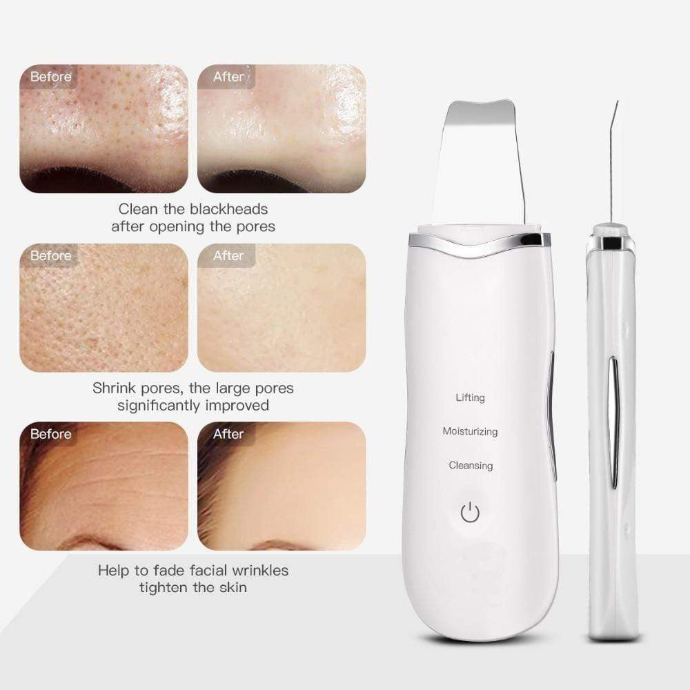Before and after results of using Deep Facial Cleanser & Face Scrubber for skin cleansing and wrinkle reduction.