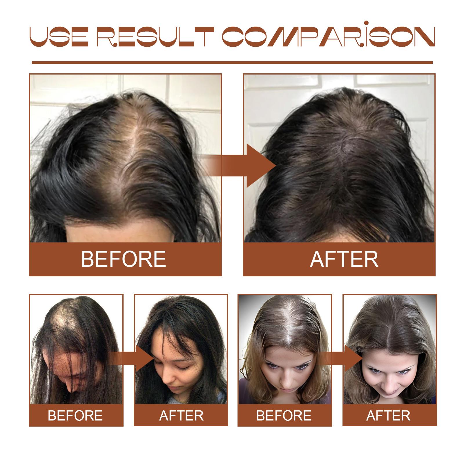 Natural Hair Regrowth Oil for Thick & Healthy Hair before and after use result comparison.